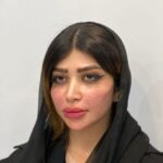 مراجعه کننده تزریق ژل لب