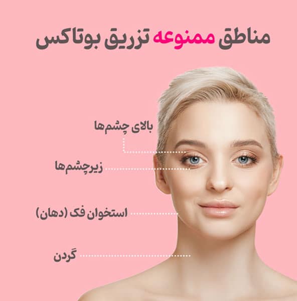 مناطق ممنوعه تزریق بوتاکس