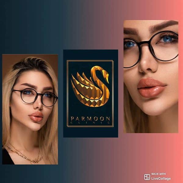 تزریق ژل چانه