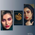 تزریق ژل و بوتاکس در بندرعباس