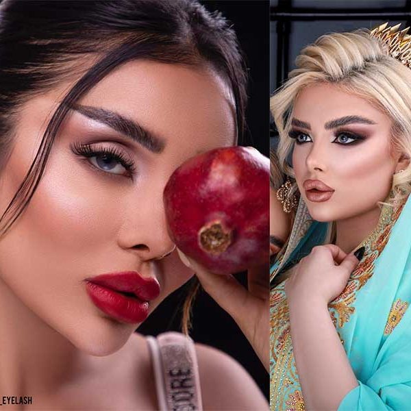 تزریق ژل گونه