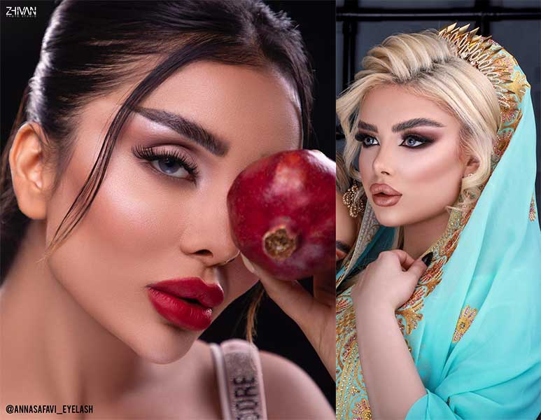 تزریق ژل گونه
