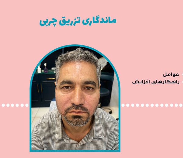 ماندگاری تزریق چربی