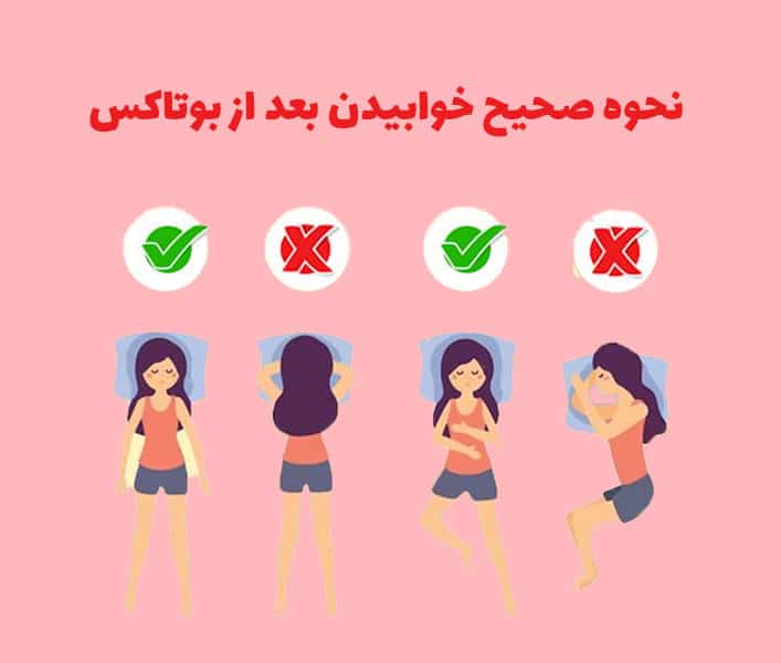 نحوه صحیح خوابیدن بعد از بوتاکس