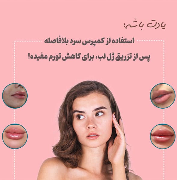 مراقبت های بعد از تزریق ژل لب