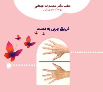 تزریق چربی به دست
