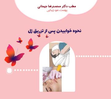 نحوه خوابیدن پس از تزریق ژل