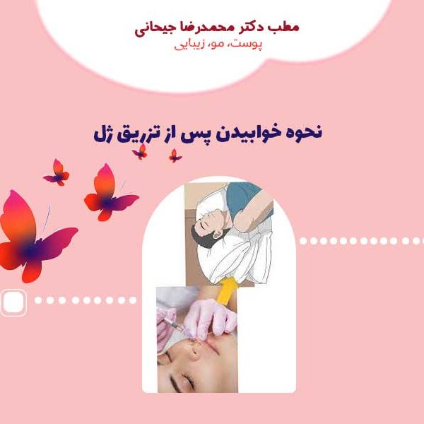 نحوه خوابیدن پس از تزریق ژل