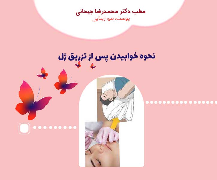 نحوه خوابیدن پس از تزریق ژل